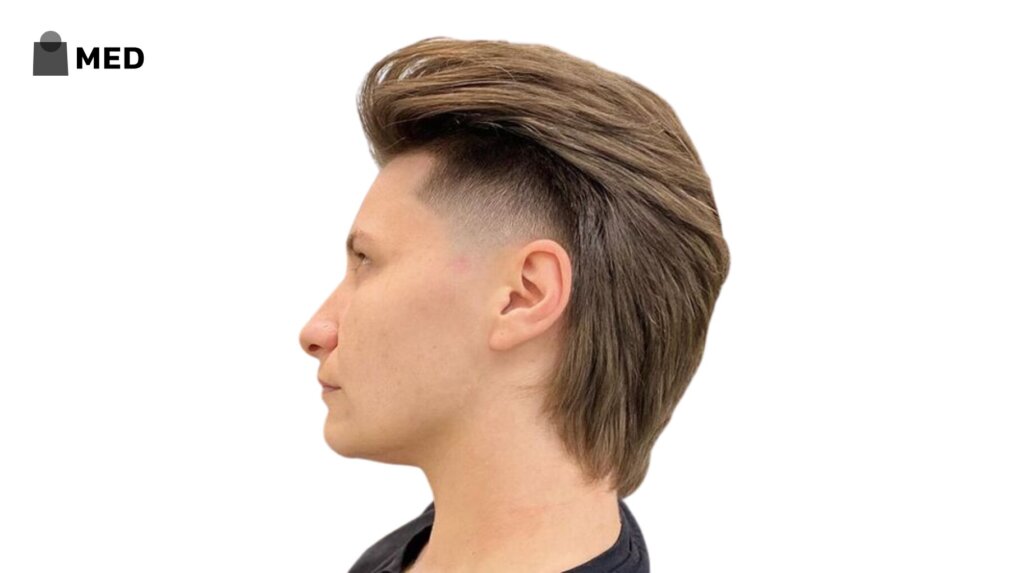 Mullet with Undercut