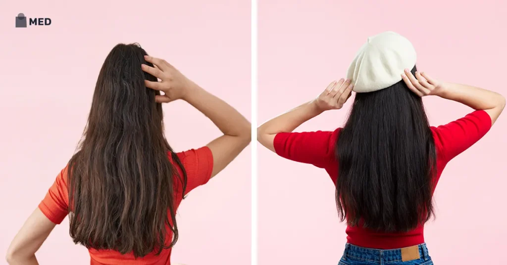 Hair before after comparison